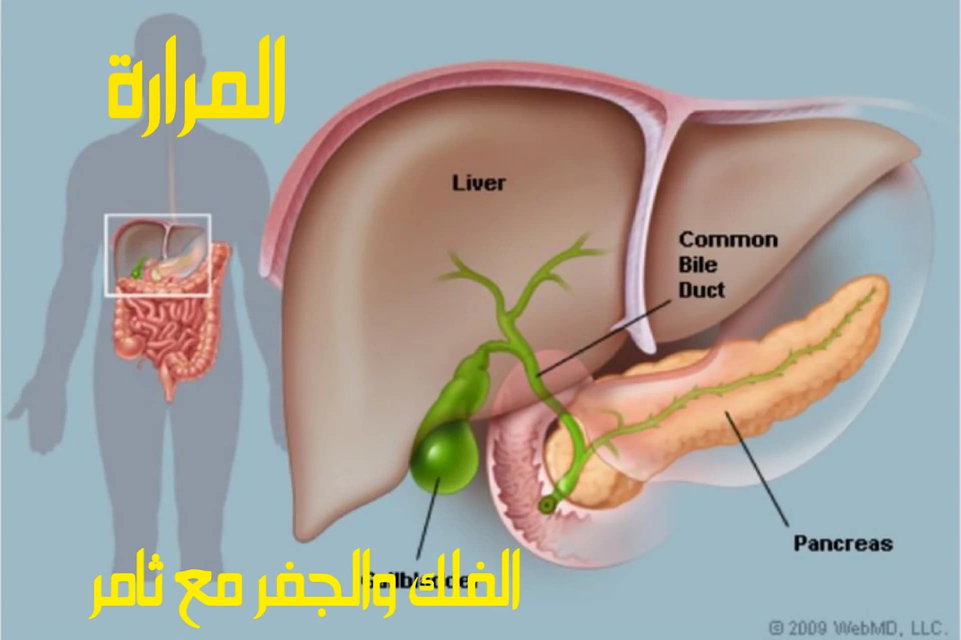 حصى المرارة