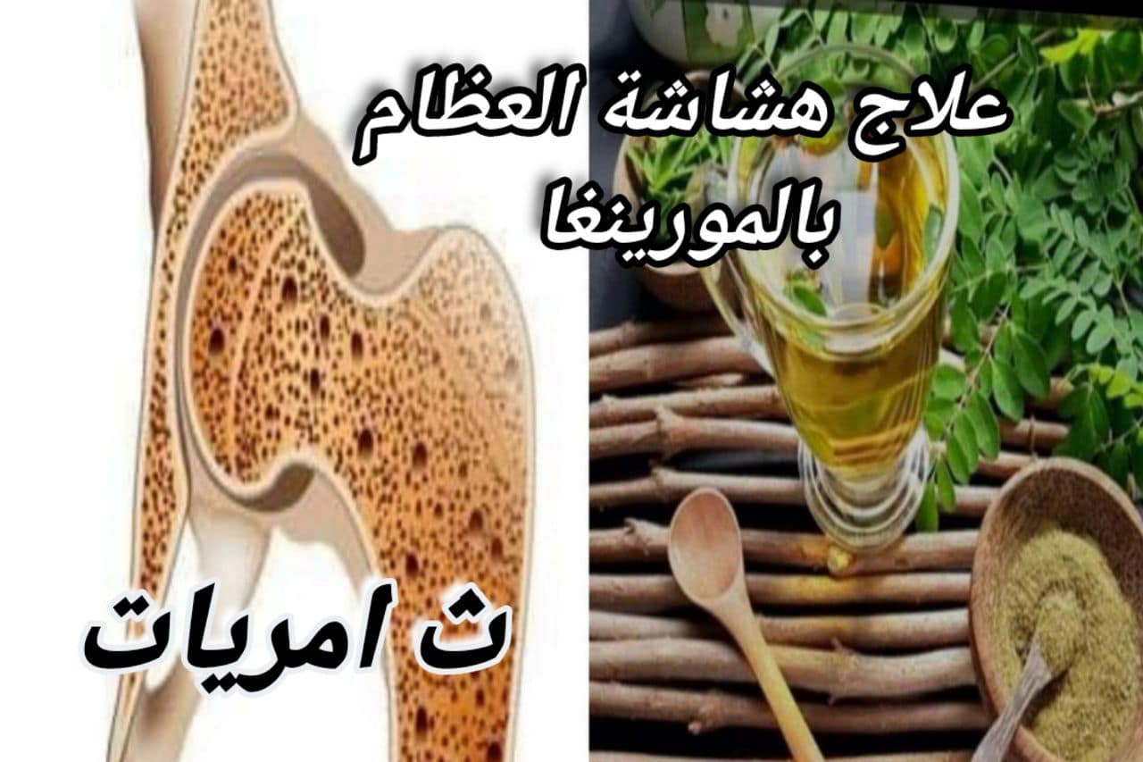 هل تعاني من هشاشة العظام؟ ماذا تعرف عن المورينغا؟